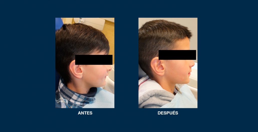ortodoncia-clinica-arco-2 - Arco Clínica Dental